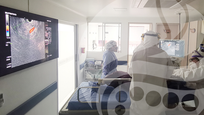 ecoendoscopia Consulta Especializada en Gastroenterología